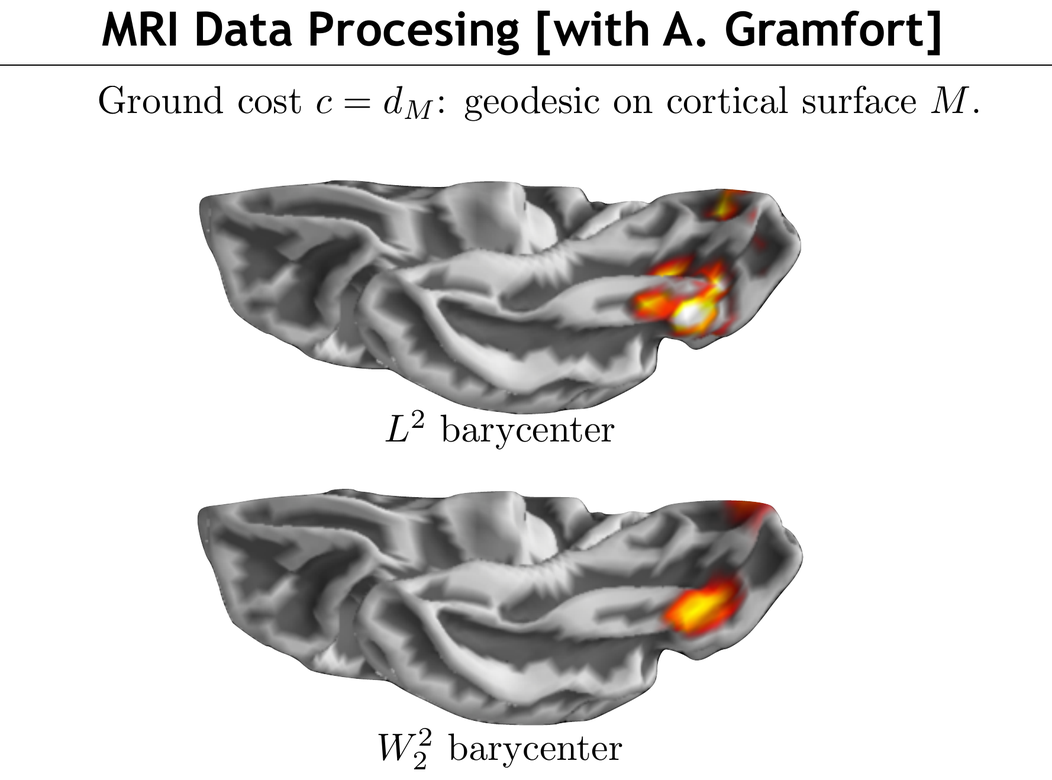 MRI cortical-surface barycenter